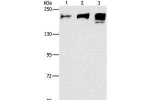 Western Blot analysis of Human ileum adenocarcinoma tissue, Human testis and prostate tissue using ACE1 Polyclonal Antibody at dilution of 1:240 (Angiotensin I Converting Enzyme 1 抗体)