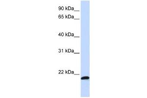 Western Blotting (WB) image for anti-Chromosome 21 Open Reading Frame 56 (C21orf56) antibody (ABIN2458971) (C21ORF56 抗体)
