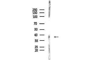 anti-Melanoma Antigen Family D, 4 (MAGED4) (C-Term) antibody
