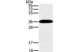 Western Blot analysis of Mouse brain tissue using PPP1CC Polyclonal Antibody at dilution of 1:200 (PPP1CC 抗体)