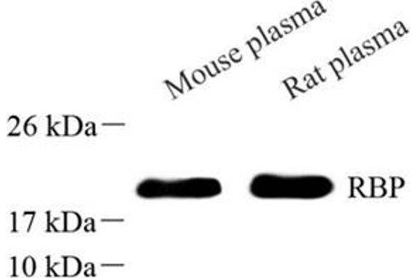 RBP4 抗体