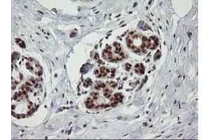Image no. 2 for anti-tRNA Methyltransferase 2 Homolog A (TRMT2A) antibody (ABIN1501516) (TRMT2A 抗体)