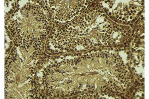 ABIN6277682 at 1/100 staining Mouse testis tissue by IHC-P. (PIAS2 抗体  (N-Term))