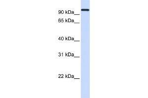 WB Suggested Anti-HSPA4 Antibody Titration: 0. (HSPA4 抗体  (Middle Region))