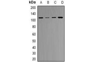 Western blot analysis of RB1 expression in A549 (A), NIH3T3 (B), K562 (C), PC12 (D) whole cell lysates. (Retinoblastoma 1 抗体)