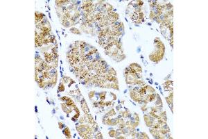 Immunohistochemistry of paraffin-embedded human stomach using COL10A1 antibody (ABIN5974149) at dilution of 1/100 (40x lens). (COL10A1 抗体)