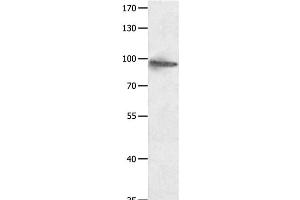Western Blot analysis of Hela cell using HCN1 Polyclonal Antibody at dilution of 1:950 (HCN1 抗体)