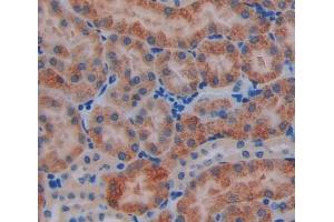 Immunohistochemistry (IHC) image for anti-Acyl-CoA Dehydrogenase, C-2 To C-3 Short Chain (Acads) (AA 210-397) antibody (ABIN5013074)
