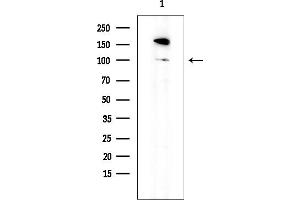 Western blot analysis of lysates from EC304 cells, using EZH2 Mouse Monoclonal Antibody at 1/1000 dilution.