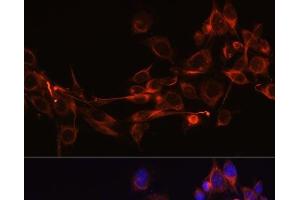 Immunofluorescence analysis of NIH-3T3 cells using DKK3 Polyclonal Antibody at dilution of 1:100 (40x lens). (DKK3 抗体)