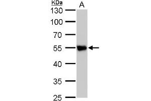 WB Image beta Tubulin 2 antibody detects beta Tubulin 2 protein by western blot analysis. (TUBB2A 抗体)