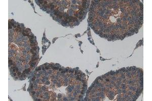 Immunohistochemistry (IHC) image for anti-Mitochondrially Encoded NADH Dehydrogenase 5 (MT-ND5) (AA 425-562) antibody (ABIN7437398)