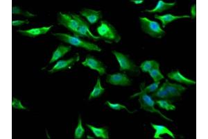 Immunofluorescence staining of Hela Cells with  at 1:50, counter-stained with DAPI. (Recombinant GSK3 beta 抗体)