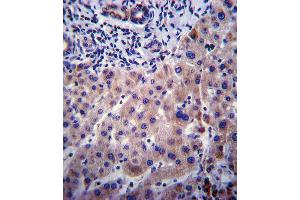 CYP3A4 Antibody (Center) ABIN392216 immunohistochemistry analysis in formalin fixed and paraffin embedded human liver tissue followed by peroxidase conjugation of the secondary antibody and DAB staining. (CYP3A4 抗体  (AA 228-255))