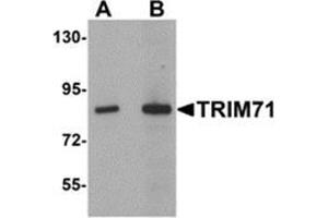 Western blot analysis of TRIM71 in human brain tissue lysate with TRIM71 antibody at (A) 1 and (B) 2 μg/ml. (TRIM71 抗体  (C-Term))