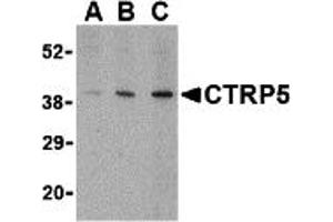 Western Blotting (WB) image for anti-C1q and Tumor Necrosis Factor Related Protein 5 (C1QTNF5) (Middle Region) antibody (ABIN1030914) (CTRP5 抗体  (Middle Region))