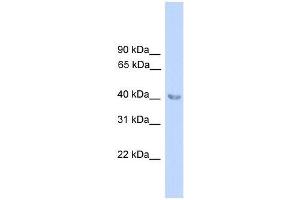 ALAD antibody used at 0. (ALAD 抗体  (N-Term))