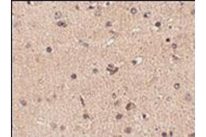 Immunohistochemistry of Slitrk2 in human brain tissue with this product at 2. (SLITRK2 抗体  (C-Term))
