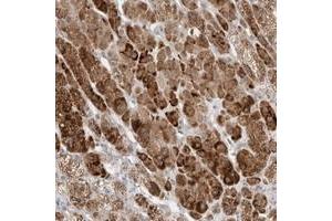 Immunohistochemical staining of human adrenal gland with BICD2 polyclonal antibody  shows strong cytoplasmic positivity in cortical cells.