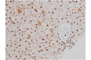 Immunohistochemistry (IHC) image for anti-Mast/stem Cell Growth Factor Receptor (KIT) (pTyr721) antibody (ABIN6256004)