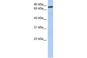 SEMA4B antibody used at 1 ug/ml to detect target protein.