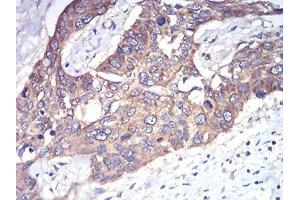 Immunohistochemistry (IHC) image for anti-RAB1B, Member RAS Oncogene Family (RAB1B) (AA 60-201) antibody (ABIN5875927) (RAB1B 抗体  (AA 60-201))