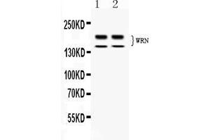 Western blot analysis of WRN expression in rat thymus extract ( Lane 1) and human placenta extract ( Lane 2). (RECQL2 抗体  (AA 122-240))