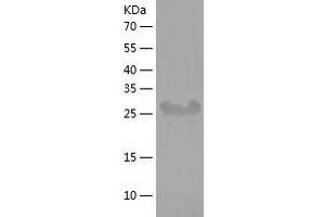 Western Blotting (WB) image for Signal Transducing Adaptor Family Member 1 (STAP1) (AA 1-295) protein (His tag) (ABIN7289387) (STAP1 Protein (AA 1-295) (His tag))