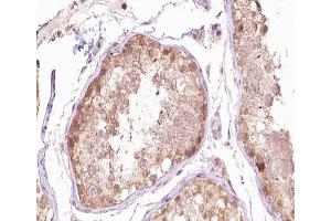 ABIN6266666 at 1/100 staining human testis tissue sections by IHC-P. (TUBG1 抗体  (N-Term))