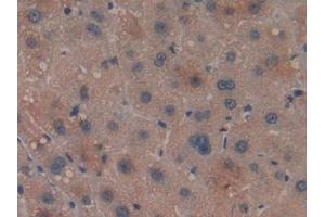 Detection of LILRB2 in Human Liver Tissue using Polyclonal Antibody to Leukocyte Immunoglobulin Like Receptor Subfamily B, Member 2 (LILRB2)