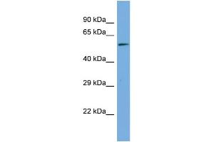Host:  Rabbit  Target Name:  MAGED2  Sample Type:  Hela Whole Cell lysates  Antibody Dilution:  1. (MAGED2 抗体  (Middle Region))