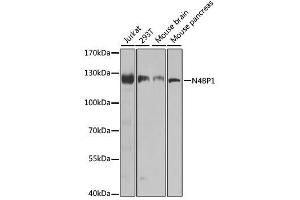 Western blot analysis of extracts of various cell lines, using N4BP1 antibody. (N4BP1 抗体  (AA 190-590))