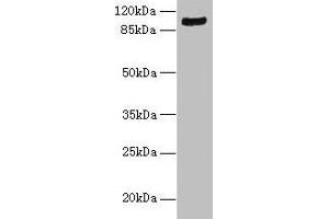 Western blot All lanes: TMTC1 antibody at 6 μg/mL + Mouse large intestine tissue Secondary Goat polyclonal to rabbit IgG at 1/10000 dilution Predicted band size: 99, 88, 74, 66, 26 kDa Observed band size: 99 kDa (TMTC1 抗体  (AA 1-227))