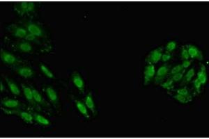 Immunofluorescent analysis of HepG2 cells using ABIN7154122 at dilution of 1:100 and Alexa Fluor 488-congugated AffiniPure Goat Anti-Rabbit IgG(H+L) (GSTT1 抗体  (AA 2-240))