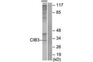 Western blot analysis of extracts from K562 cells, using CIB3 Antibody. (CIB3 抗体  (AA 138-187))