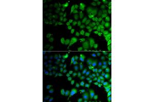 Immunofluorescence analysis of A549 cell using JMJD7 antibody. (JMJD7 抗体)