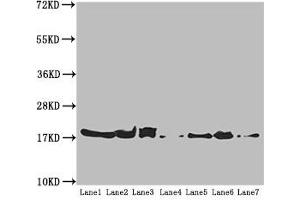 Western blot All lanes: ATP5H antibody at 5. (ATP5H 抗体  (AA 1-161))