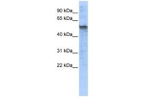 TPH2 antibody used at 1 ug/ml to detect target protein. (Tryptophan Hydroxylase 2 抗体  (Middle Region))