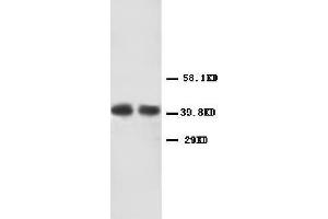 Anti-CXCR2 antibody, Western blotting Lane 1: Human Rectal Cancer Tissue Lysate Lane 2: Human Rectal Cancer Tissue Lysate (CXCR2 抗体  (Middle Region))