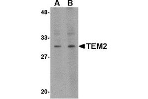 Western Blotting (WB) image for anti-RASD Family, Member 2 (RASD2) (C-Term) antibody (ABIN1030728) (RASD2 抗体  (C-Term))