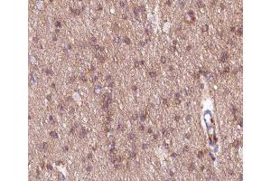 ABIN6266547 at 1/200 staining human brain tissue sections by IHC-P. (mGluR2/3 抗体)