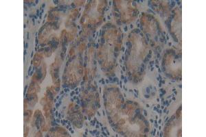 Used in DAB staining on fromalin fixed paraffin- embedded stomach tissue (Calpain 9 抗体  (AA 42-340))