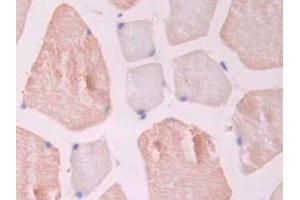 Detection of ENG in Rat Skeletal muscle Tissue using Polyclonal Antibody to Endoglin (ENG) (Endoglin 抗体  (AA 26-136))