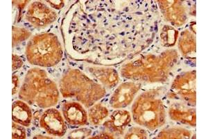 Immunohistochemistry of paraffin-embedded human kidney tissue using ABIN7155721 at dilution of 1:100 (HOXA5 抗体  (AA 1-270))