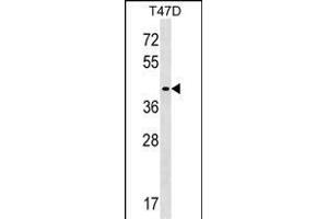 ADHC Antibody (C-term) (ABIN1536884 and ABIN2849555) western blot analysis in T47D cell line lysates (35 μg/lane). (MMADHC 抗体  (C-Term))
