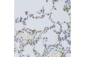 Immunohistochemistry of paraffin-embedded rat lung using HMGB1 Antibody. (HMGB1 抗体  (AA 100-200))