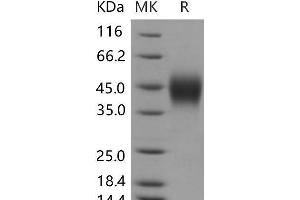 Western Blotting (WB) image for Interferon gamma Receptor 1 (IFNGR1) (Active) protein (His tag) (ABIN7196273) (IFNGR1 Protein (His tag))