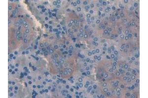 IHC-P analysis of Rat Adrenal gland Tissue, with DAB staining. (SLIT3 抗体  (AA 62-119))