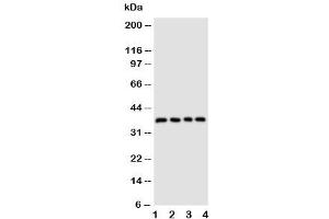 Western blot testing of CD1d antibody and Lane 1:  COLO320 (CD1d 抗体  (AA 76-92))