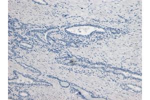 ABIN190842 Negative Control showing staining of paraffin embedded Human Prostate, with no primary antibody.